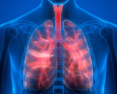 Malaltia pulmonar obstructiva crònica (MPOC)