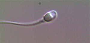 Espermatozoide amb IMSI