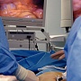 Fig. 1. Cirurgia laparoscòpica de la colelitiasi