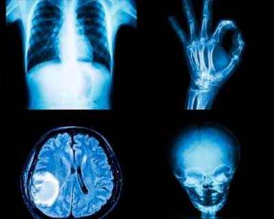 En la diagnosis de radiografía