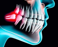 Cirugía oral y maxilofacial · LOFACIAL